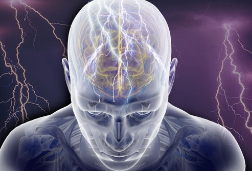 What is Epilepsy? – Epilepsy Ontario